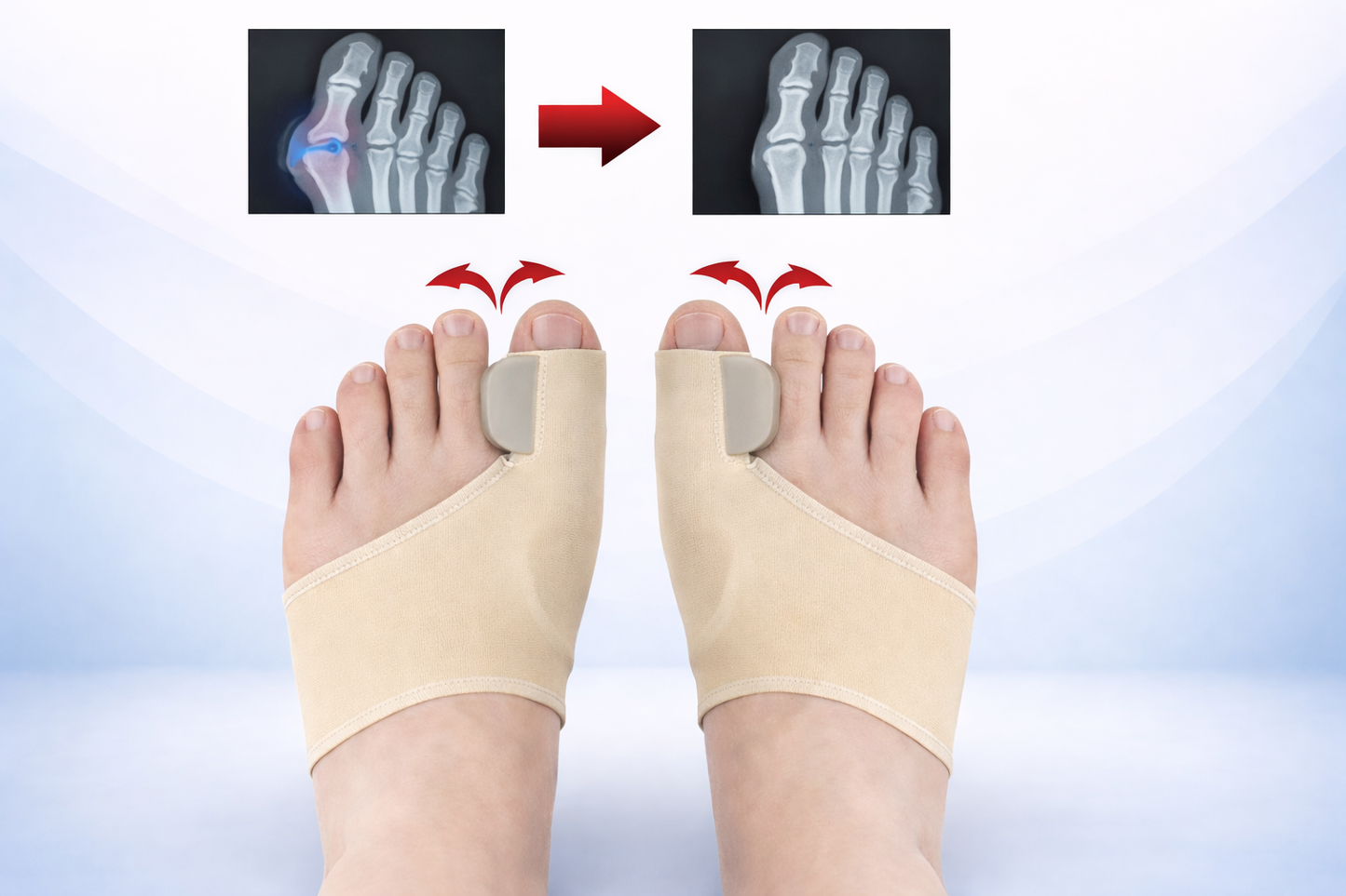 ToeCare – Soft Toe Separators for Daily Foot Comfort