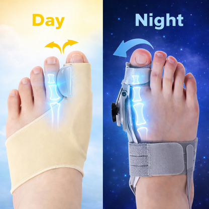 ToeCare – Soft Toe Separators for Daily Foot Comfort